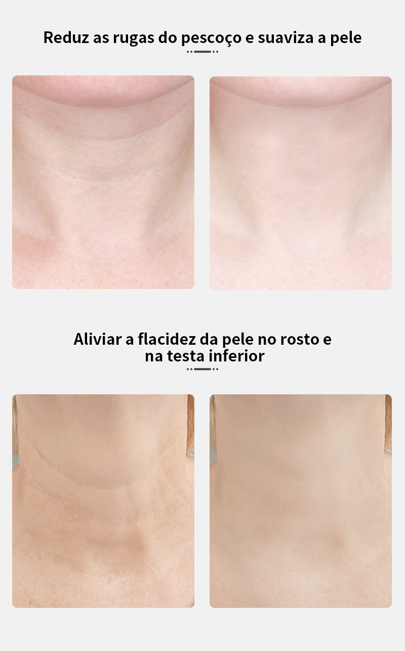 A Magia do ANLAN LUZ: Ilumine sua Pele e Renove sua Beleza! 2 S3a50f1e7aa944737bf5f9c1d17523ee4a